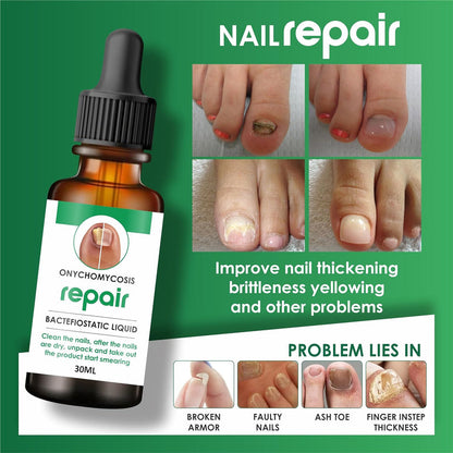 Nails Strong Growth And Repair Oli ( Pack Of 2)